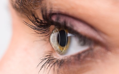 A potential gamechanger for the treatment of keratoconus